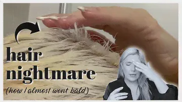 MY HAIR GOT BURNED OFF AND I ALMOST WENT BALD! | HAIR RECOVERY ❤️‍🩹 EP. 1
